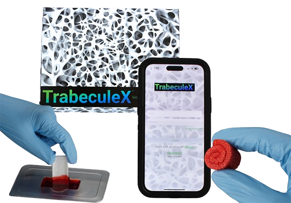 TrabeculeX Continuum